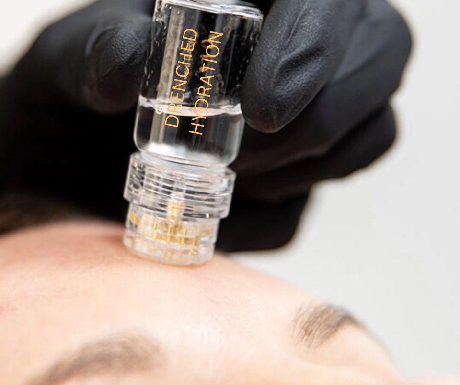 Microchanneling treatment device close-up